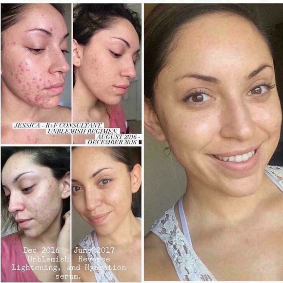 Rodan +Fields Deals and Sales - Picture 5 of 8